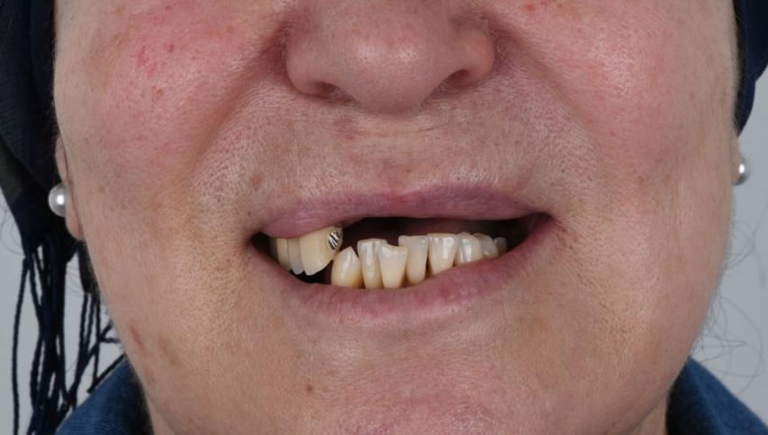 Original - Man holding beer