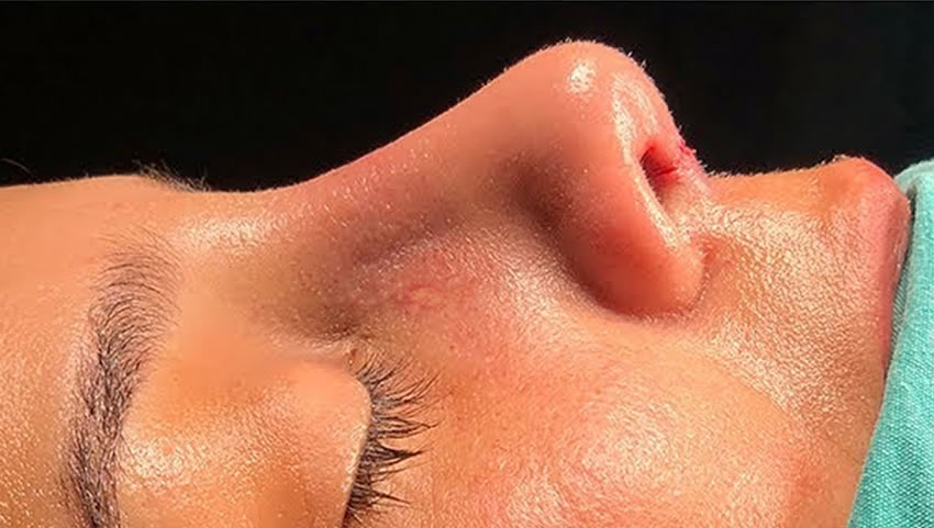 Processed - Man holding beer